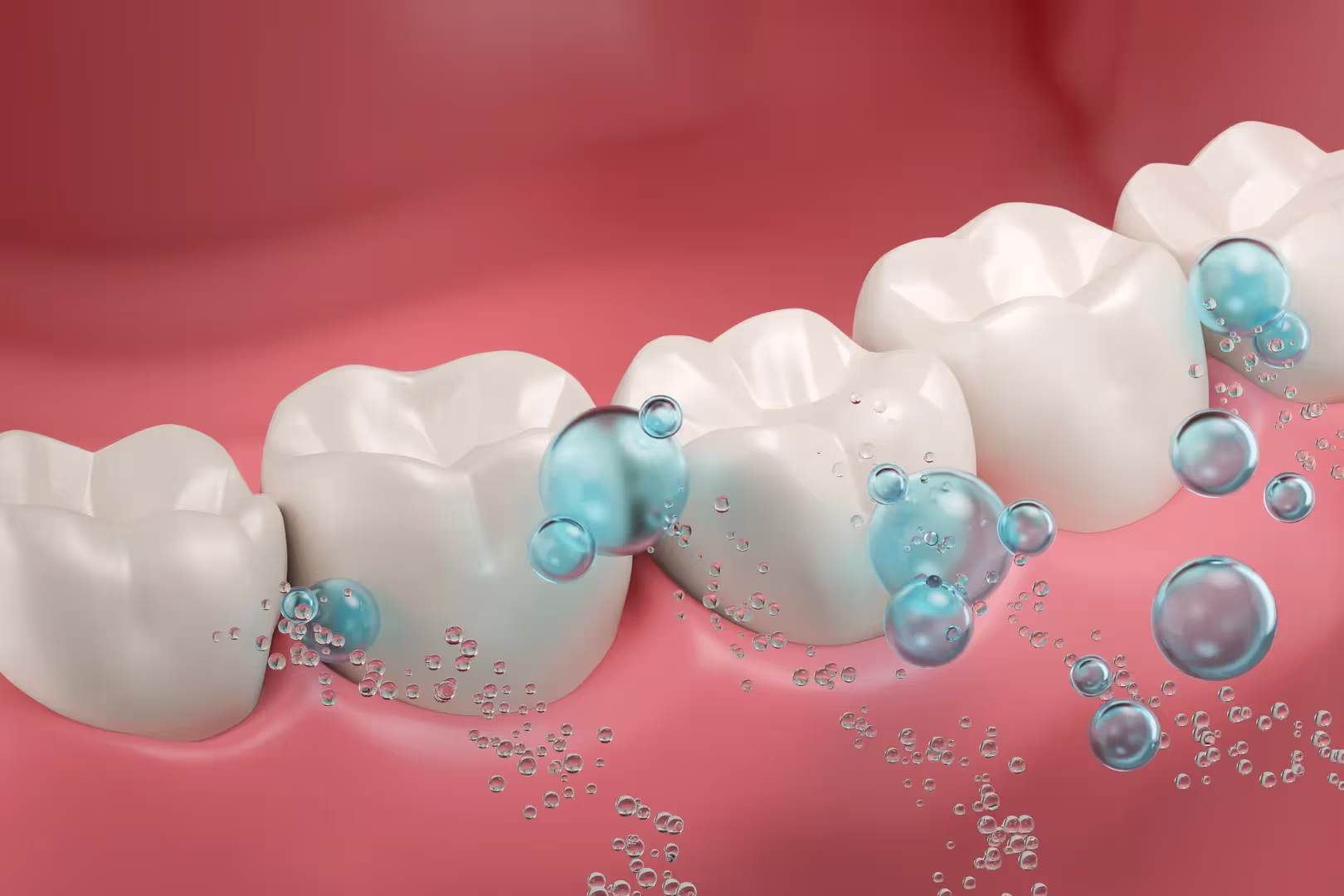 Fluoride Treatments in Mesquite with Dr. Ken Taylor