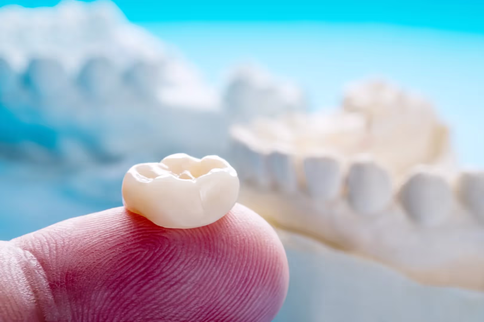 High-Quality Dental Crowns in Mesquite, TX